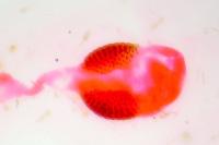 Phycitodes albatella