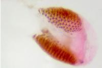 Phycitodes inquinatella