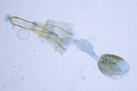 Phycitodes albatella