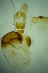 Hoplodrina