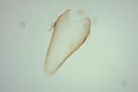 Phyllonorycter mespilella