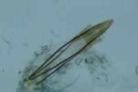 Eteobalea albiapicella