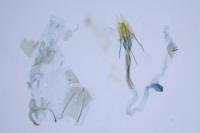 Coleophora glaucicolella