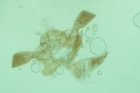 Metzneria aestivella