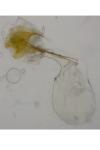 Coleophora
