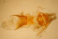 Aethes bilbaensis