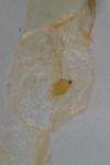 Oegoconia