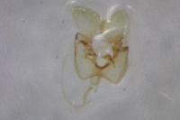 Parornix atripalpella