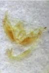 Stenoptilia pterodactyla