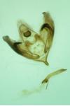 Depressaria radiosquamella