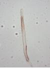 Agnathosia mendicella