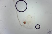 Neofaculta infernella