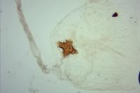 Neofaculta infernella