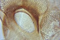 Neofaculta infernella