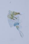 Ectoedemia turbidella