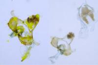 Coleophora albidella