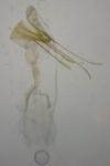 Cnephasia incertana