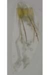 Metzneria hilarella