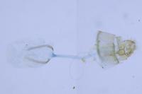 Parornix atripalpella
