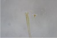 Lyonetia prunifoliella