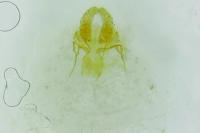 Phalonidia contractana