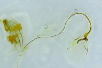 Archips xylosteana