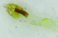 Pseudoswammerdamia combinella