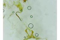 Stenoptilia bipunctidactyla