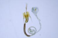 Coleophora versurella