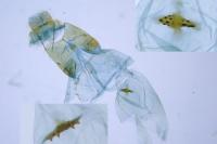 Depressaria radiosquamella