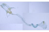 Coleophora valesianella