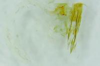Crassa unitella