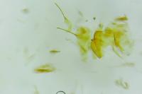 Aproaerema anthyllidella