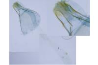 Tinea pellionella