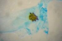 Acleris cristana