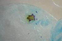 Acleris hastiana