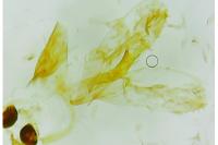 Parectopa ononidis