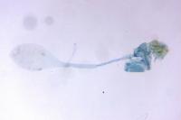 Parornix finitimella