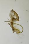 Aproaerema anthyllidella