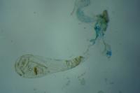 Agonopterix