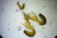Dichrorampha alpinana