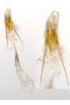 Tinea trinotella