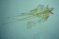 Heliozela lithargyrellum