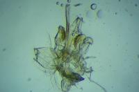 Argyresthia abdominalis