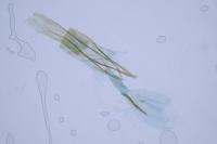 Cnephasia incertana