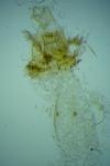 Parornix torquillella