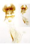 Cnephasia asseclana