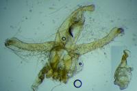 Neofaculta ericetella