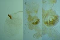 Neofaculta ericetella