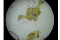 Metzneria metzneriella